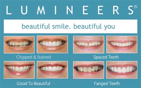 what does lumineers mean